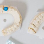 What Makes Dental Implants the Best Option for Tooth Replacement